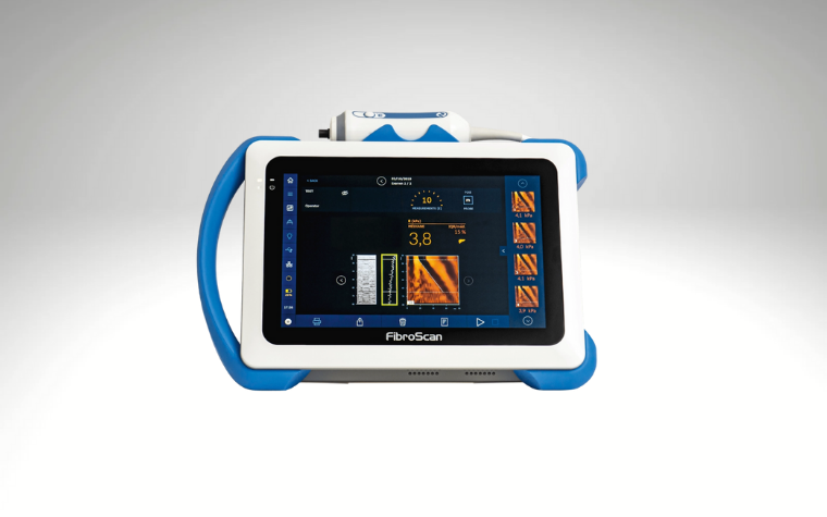 FIBROSCAN CİHAZI